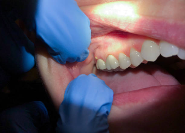 Best Orthodontic Emergency Dentist in Madison, IN